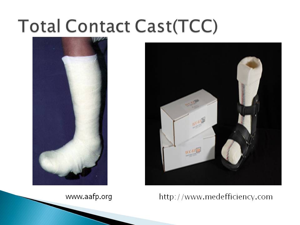 Figure 54 Total Contact Cast