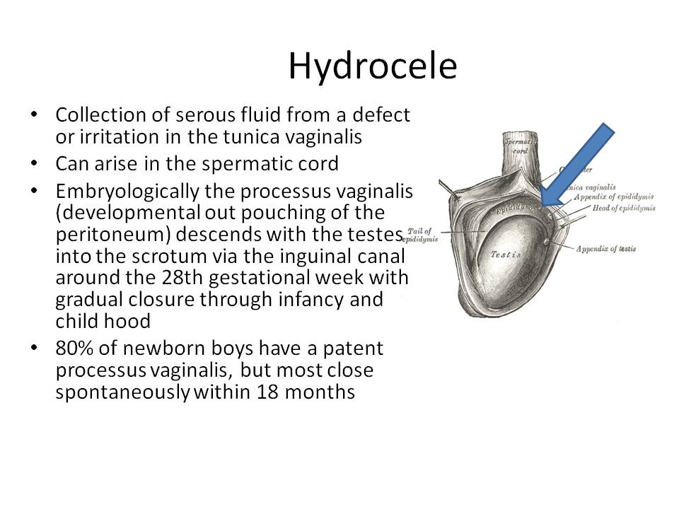 Groin Pain Steven Tippett 2042