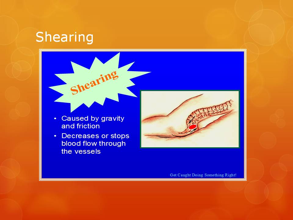 Figure 28 Illustration of shear