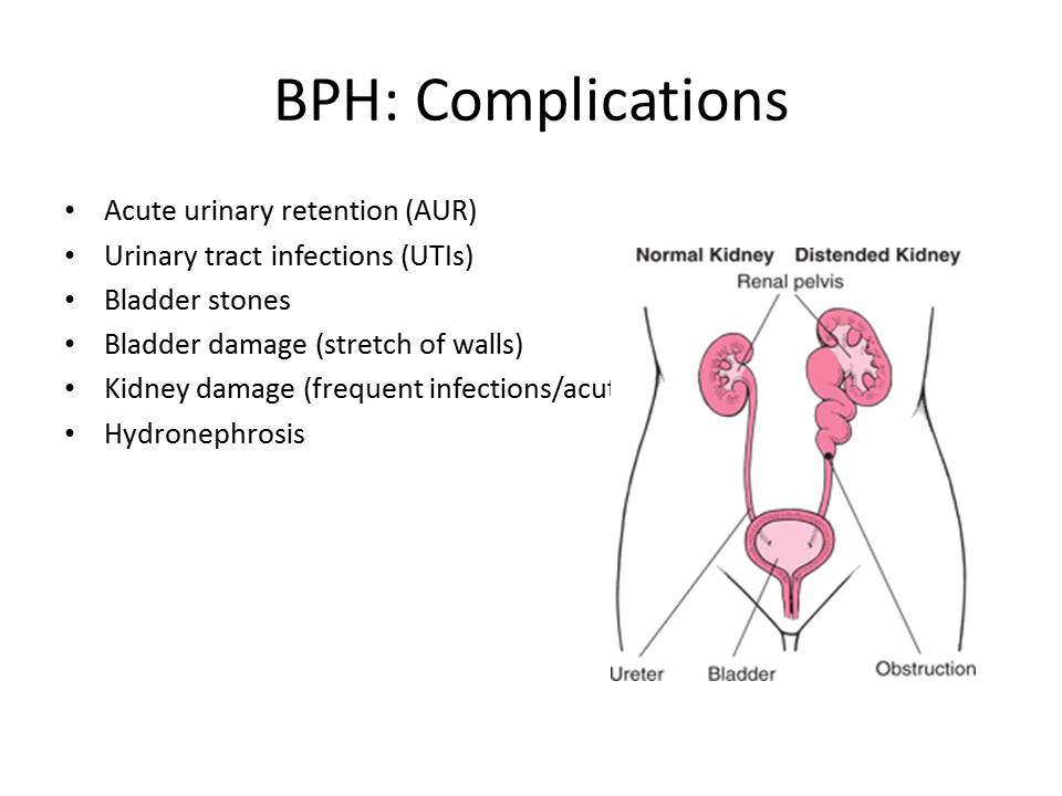 Groin Pain Steven Tippett 2042